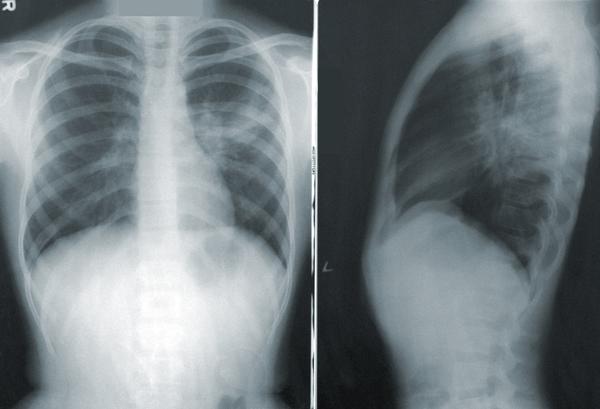 x-ray scan